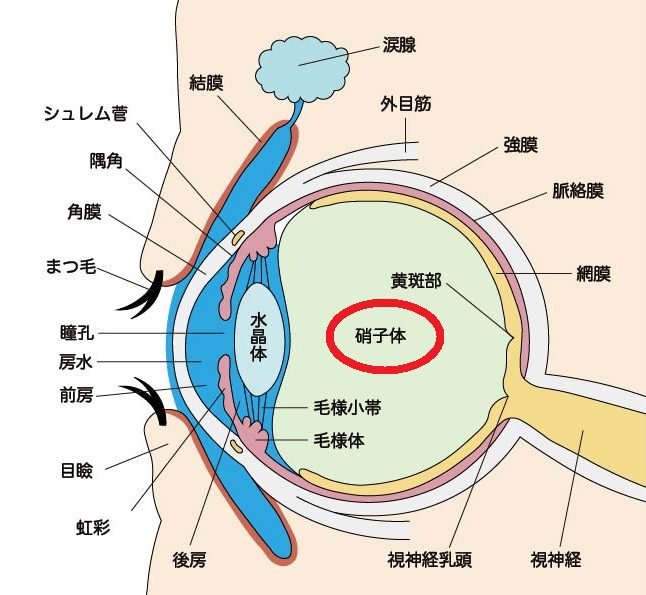 硝子体出血